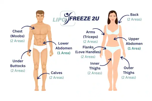 Areas you can have fat freezing treatment Poole