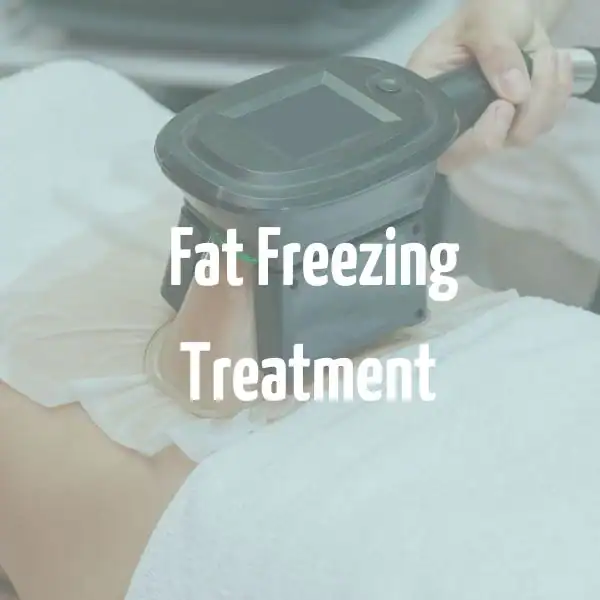 fat freezing treatment Poole