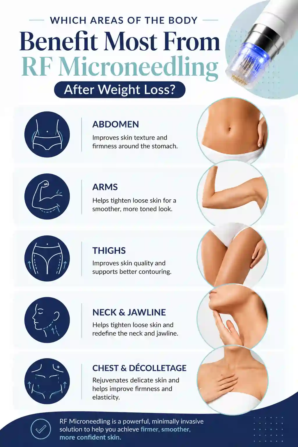 Which Areas of the Body Benefit Most From RF Microneedling After Weight Loss Poole